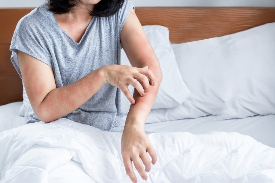 O que fazer com alergia ao calor no quotidiano