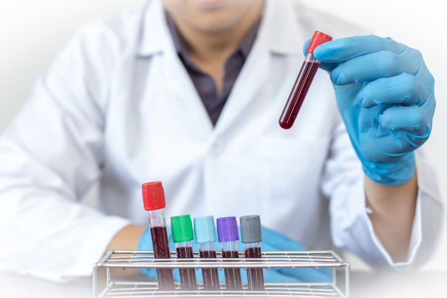 O que significa proteína C reativa alta